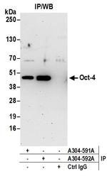 Oct-4 Antibody in Immunoprecipitation (IP)