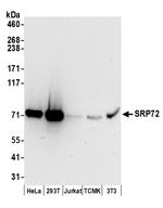 SRP72 Antibody in Western Blot (WB)