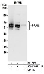 PPAN Antibody in Immunoprecipitation (IP)