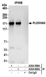 PLEKHA5 Antibody in Immunoprecipitation (IP)