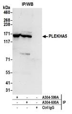 PLEKHA5 Antibody in Immunoprecipitation (IP)