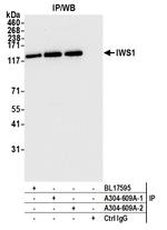 IWS1 Antibody in Immunoprecipitation (IP)