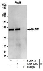 N4BP1 Antibody in Immunoprecipitation (IP)