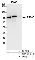 LRRC47 Antibody in Immunoprecipitation (IP)