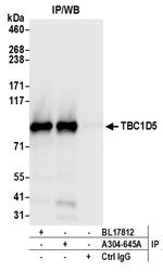 TBC1D5 Antibody in Immunoprecipitation (IP)