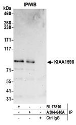 KIAA1598 Antibody in Immunoprecipitation (IP)