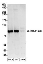 KIAA1598 Antibody in Western Blot (WB)