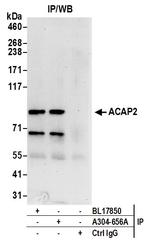 ACAP2 Antibody in Immunoprecipitation (IP)