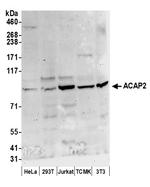 ACAP2 Antibody in Western Blot (WB)