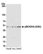 Phospho-BCKDE1A (Ser292) Antibody in Western Blot (WB)