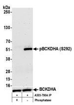 Phospho-BCKDE1A (Ser292) Antibody in Western Blot (WB)