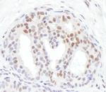 Phospho-Chk1 (Ser317) Antibody in Immunohistochemistry (Paraffin) (IHC (P))