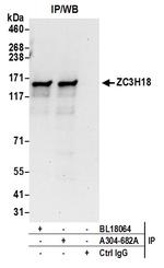 ZC3H18 Antibody in Immunoprecipitation (IP)