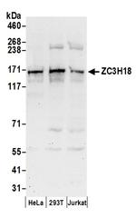 ZC3H18 Antibody in Western Blot (WB)