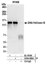 DNA Helicase B Antibody in Immunoprecipitation (IP)