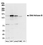 DNA Helicase B Antibody in Western Blot (WB)