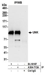 UNK Antibody in Immunoprecipitation (IP)