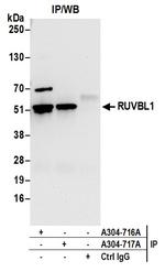 RUVBL1 Antibody in Immunoprecipitation (IP)