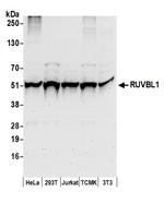 RUVBL1 Antibody in Western Blot (WB)