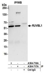 RUVBL1 Antibody in Immunoprecipitation (IP)