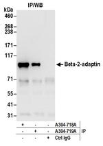 Beta-2-adaptin Antibody in Immunoprecipitation (IP)