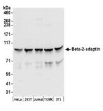 Beta-2-adaptin Antibody in Western Blot (WB)