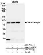 Beta-2-adaptin Antibody in Immunoprecipitation (IP)