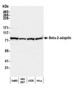 Beta-2-adaptin Antibody in Western Blot (WB)