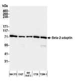 Beta-2-adaptin Antibody in Western Blot (WB)