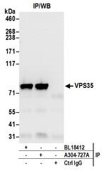 VPS35 Antibody in Immunoprecipitation (IP)