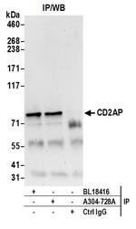 CD2AP Antibody in Immunoprecipitation (IP)