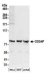 CD2AP Antibody in Western Blot (WB)