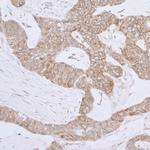 LRPPRC Antibody in Immunohistochemistry (Paraffin) (IHC (P))