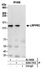 LRPPRC Antibody in Immunoprecipitation (IP)