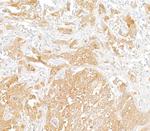 PHGDH Antibody in Immunohistochemistry (Paraffin) (IHC (P))