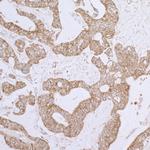 DLD Antibody in Immunohistochemistry (Paraffin) (IHC (P))