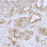 DLD Antibody in Immunohistochemistry (Paraffin) (IHC (P))