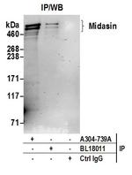 Midasin Antibody in Immunoprecipitation (IP)