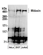 Midasin Antibody in Western Blot (WB)