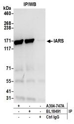 IARS Antibody in Immunoprecipitation (IP)