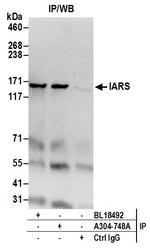 IARS Antibody in Immunoprecipitation (IP)