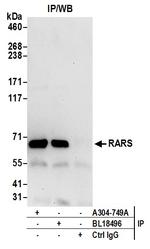 RARS Antibody in Immunoprecipitation (IP)