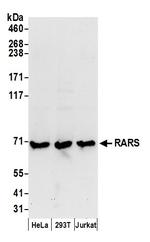 RARS Antibody in Western Blot (WB)