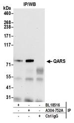 QARS Antibody in Immunoprecipitation (IP)