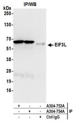 EIF3L Antibody in Immunoprecipitation (IP)