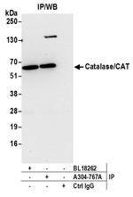 Catalase/CAT Antibody in Immunoprecipitation (IP)