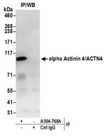 alpha Actinin 4/ACTN4 Antibody in Immunoprecipitation (IP)