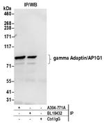 gamma Adaptin/AP1G1 Antibody in Immunoprecipitation (IP)