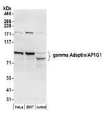 gamma Adaptin/AP1G1 Antibody in Western Blot (WB)