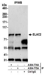 ELAC2 Antibody in Immunoprecipitation (IP)